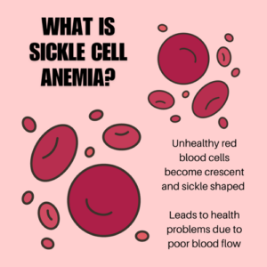 Clinical Trial Compares Two Treatments for Sickle Cell Anemia in Kids ...