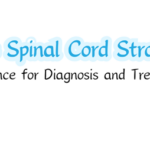 Pediatric Spinal Cord Strokes: Expert Guidance for Diagnosis and Treatment
