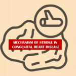 Stroke Matters in Children with Congenital Heart Diseases