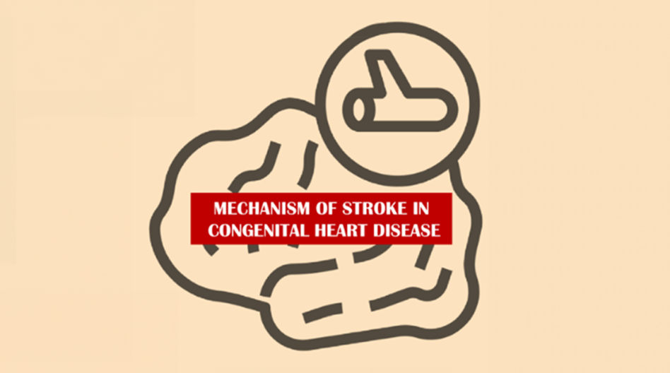 Stroke Matters in Children with Congenital Heart Diseases