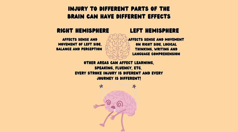 An Overview of Stroke Sequelae