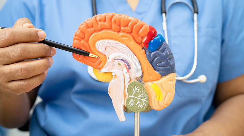 Surgical Comorbidity of Acute Stroke: Increase Intercranial Hypertension & Hydrocephalus