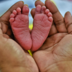 Health Inequities in Neonatal Stroke: Closing the Gap