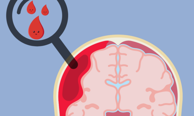 Brain Bleeds in Children: A Study of Cases in Hong Kong