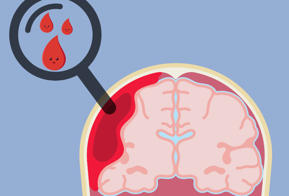 Brain Bleeds in Children: A Study of Cases in Hong Kong