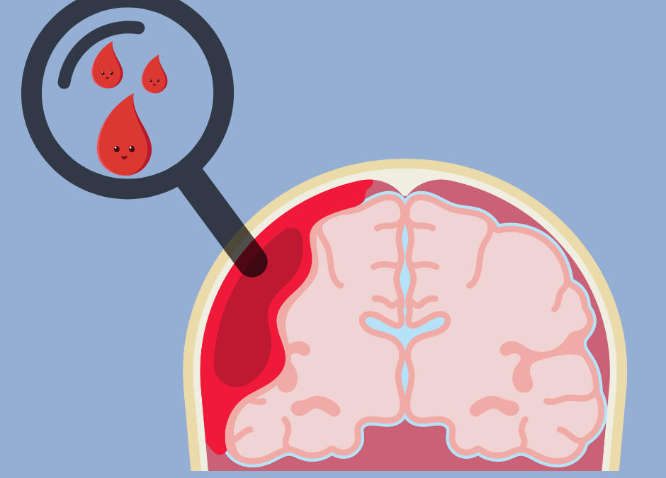 Brain Bleeds in Children: A Study of Cases in Hong Kong